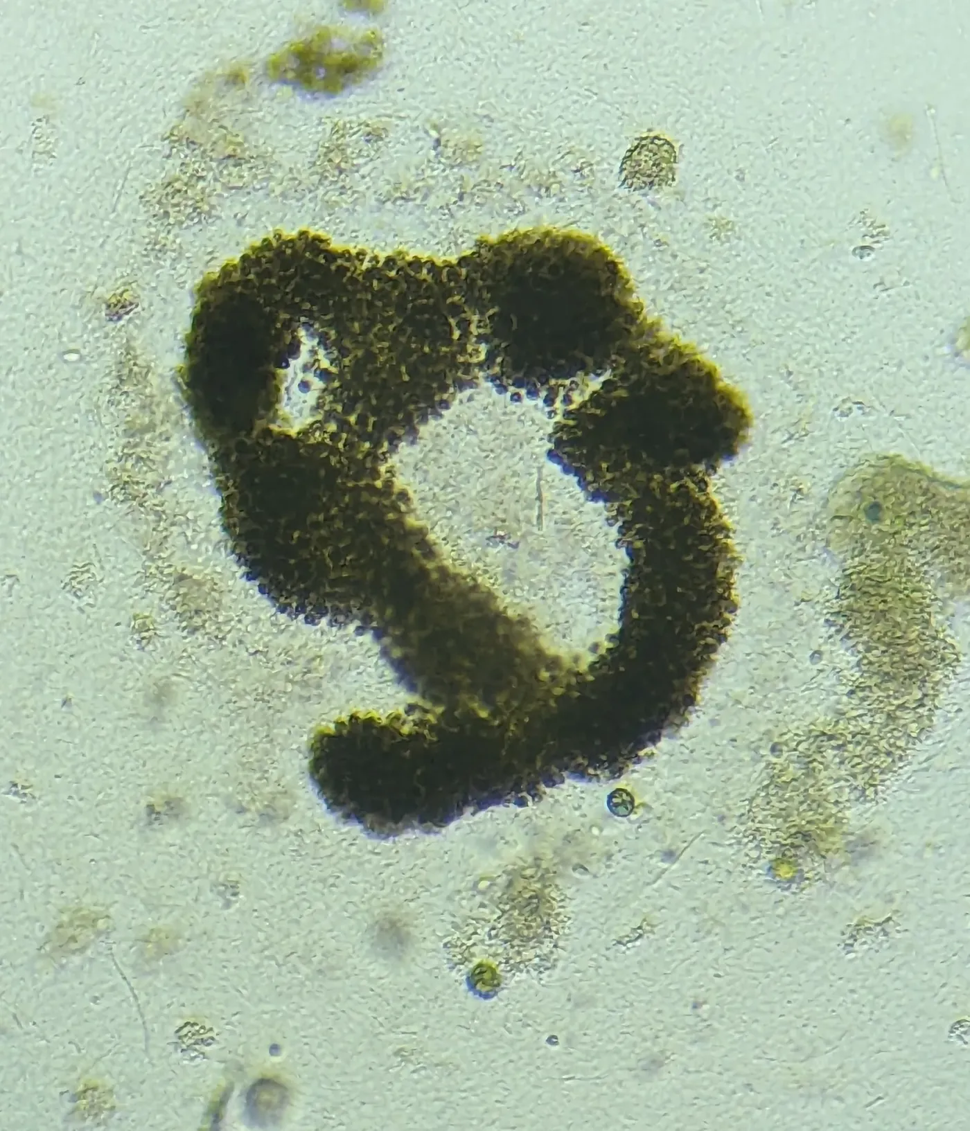Microscope image of a Microcystis aeruginosa colony made up of many small cells